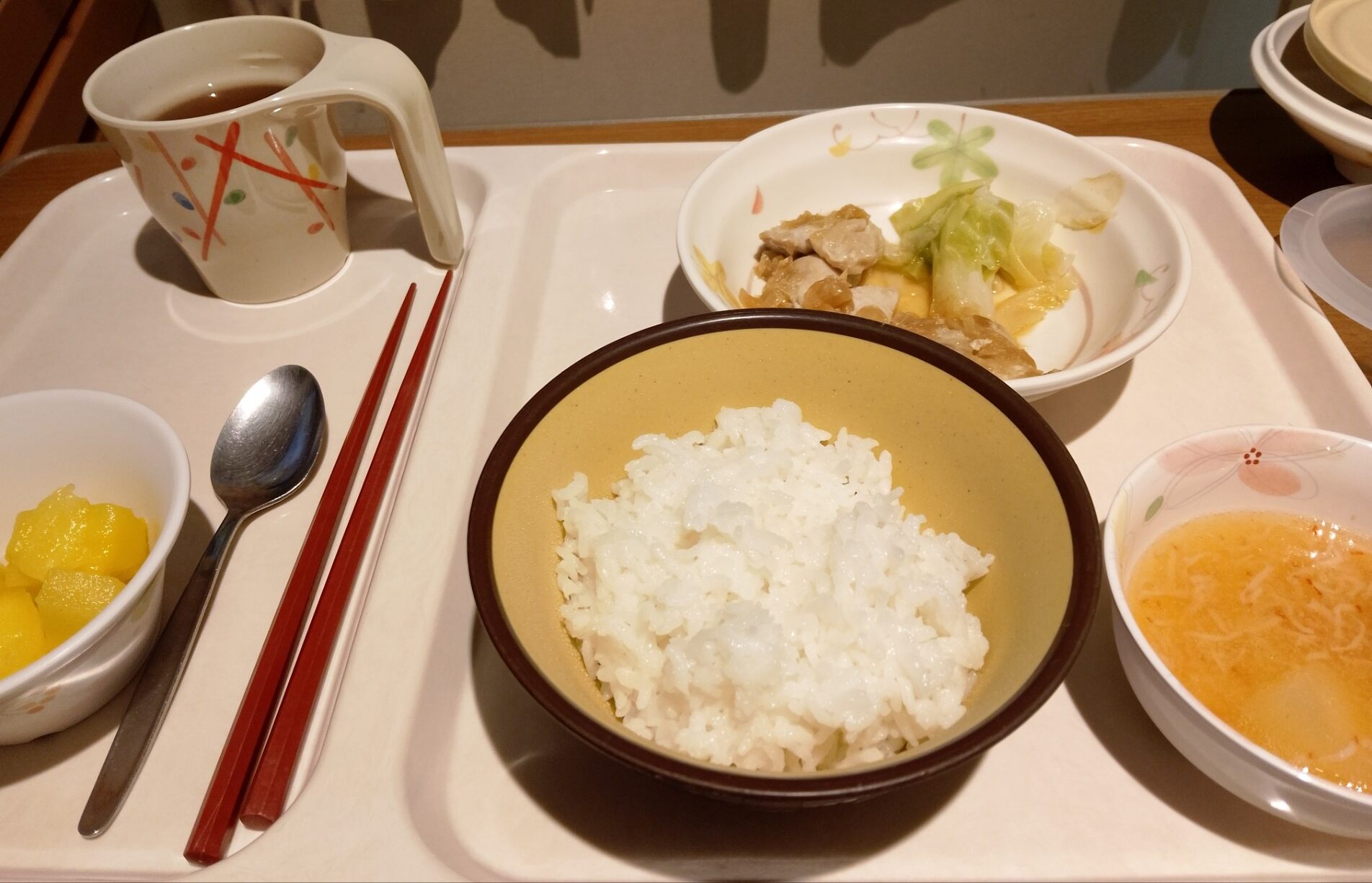 結石の内視鏡手術②